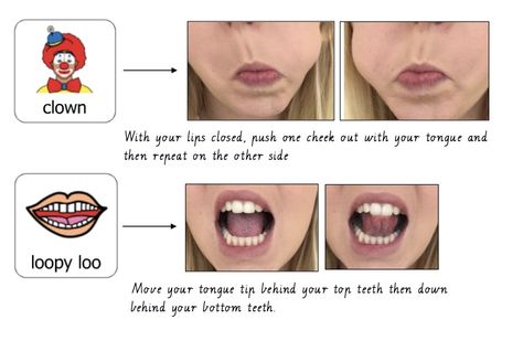 Tongue Strengthening Exercises, Tongue Exercises Speech Therapy, Tongue Exercises, Tongue Pictures, Myofunctional Therapy, Exercise Images, Speech Therapy Tools, Speech Language Activities, Oral Motor