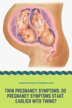 Twin Pregnancy Symptoms, How To Conceive Twins, Extreme Fatigue, Baby Wrap Newborn, How To Conceive, Gestational Age, Pregnancy Info, Pregnancy Art, Pregnancy Hormones