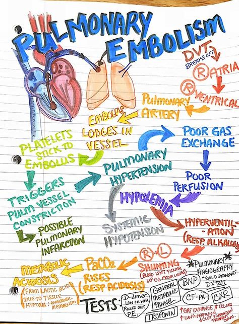 Pulmonary Embolism | Respiratory | NurseLife Respiratory Therapy Student Notes, Respiratory Therapy Notes, Paramedic School, Med Surg Nursing, Nurse Study Notes, Nursing Mnemonics, Cardiac Nursing, Pulmonology, Respiratory Care