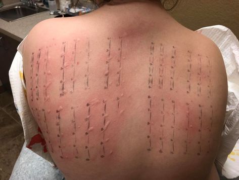 allergy test Atkins Diet Recipes Phase 1, Taco Boats, Atkins Diet Recipes, Onion Vegetable, Mini Tacos, Weight Watchers Breakfast, Taco Casserole, Allergy Testing, Atkins Diet