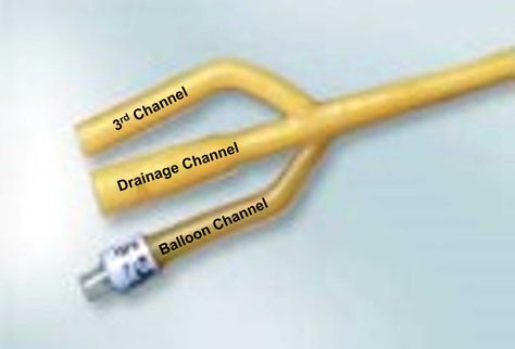 Indwelling Urinary Catheter-related Problems Indwelling Catheter Nursing, Port A Catheter, Drainage Channel, Self Monitoring, Acute Care, Social Determinants Of Health, Health Policy, Urinary Tract, Signs And Symptoms