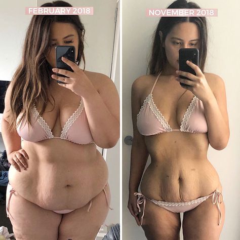 Woman Reveals Before-And-After Pictures Of Her 141-Pound Weight Loss, And She's Completely Transparent About It Transformation Du Corps, Sleeve Surgery, Lose 30 Pounds, Fitness Challenge, Food Facts, Transformation Body, Lose Belly, Lose Belly Fat, Belly Fat