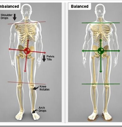 Hip Stability Exercises, Psoas Release, Runners Knee, Stability Exercises, Pelvic Tilt, Chiropractic Adjustment, Tight Hip Flexors, Muscle Imbalance, Psoas Muscle