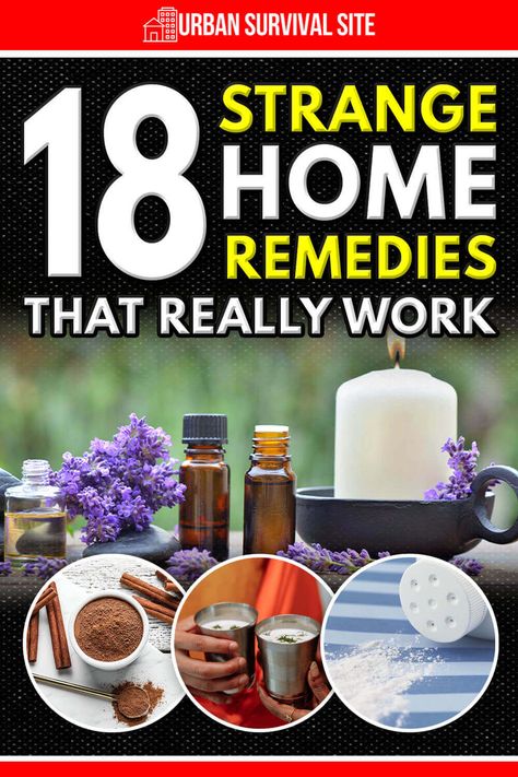 Bug Bites Remedies, Brat Diet, Best Cough Remedy, Raw Potato, Home Remedy For Cough, Cold Sores Remedies, Natural Sleep Remedies, Urban Survival, Natural Cold Remedies