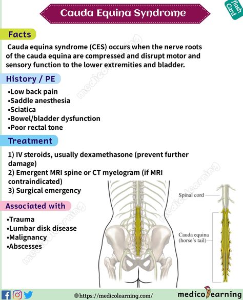 Cauda equina syndrome flashcard Cauda Equina, Relaxation Response, Flash Card, In The Morning, The Morning, Anatomy, Relaxation, Human