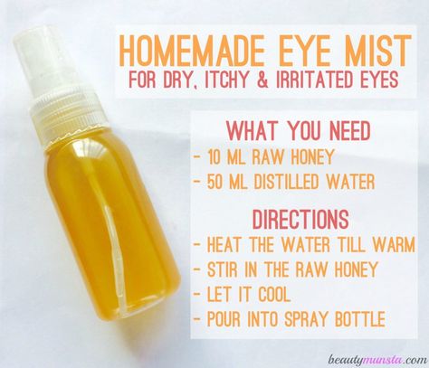 Homemade Eye Spray for Itchy & Irritated Eyes Natural Beauty Hacks, Dry Eyes Causes, Swollen Eyes, Salve Recipes, Irritated Eye, Allergy Remedies, Eye Infections, Itchy Eyes, Healthy Eyes