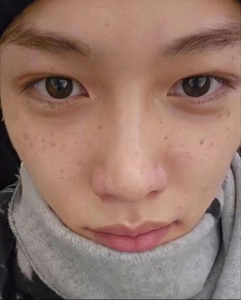 felix insta stories update 231217 Beautiful Freckles, Prince Felix, Freckle Face, Bare Face, Skz In Cute, Homeless Children, Felix Stray Kids, Lee Know, Boy Bands