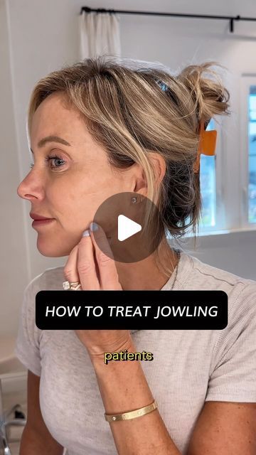 N2 Aesthetics | Medical Spa on Instagram: "The Dreaded Jowls   Preventing and treating jowls often requires a combination of treatments. Here’s a quick guide by @katieboand_pa:   Multifactorial Causes: - Volume loss - Collagen depletion - Sagging skin - Shifting fat pads - DAO and platysmal bands pulling down  Prevention is Key  Botox:Relaxes muscles that pull the jowls downward. Treating the DAO and platysmal muscle is incredibly important in prevention.   Increase Collagen and Elastin: *Softwave: Uses ultrasound waves to boost collagen and elastin production. *Microneedling  *Lasers  Filler: can add subtle volume to key areas like the preauricular area and prejowl sulcus.   #jowl  #jowling #DAO #platysmalbands #antiwrinkle #collagenproduction #dermalfiller  #katieboandpa #n2aesthetics #p How To Lift Sagging Jowls, How To Prevent Jowls, Jowls Makeup, Jowls Sagging, Platysmal Bands, Botox Injection Sites, Injection Sites, Collagen Injections, Botox Injection