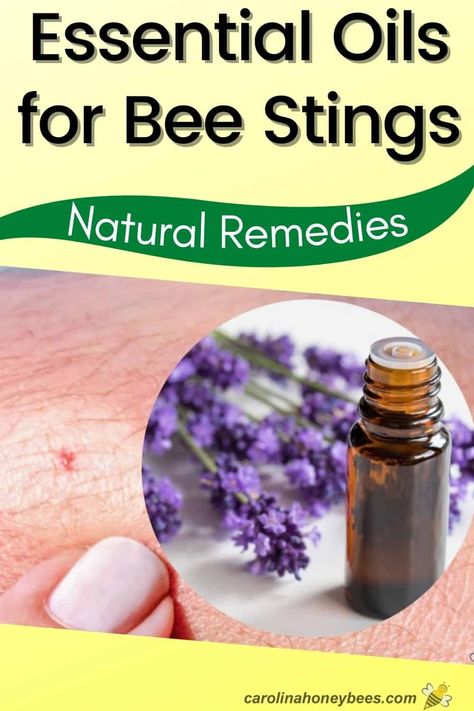 Top Essential Oils for Bee Sting Relief Here are some of the top essential oils used for relief from bee stings. These natural compounds are powerful. Consult your physician if you have any concerns. Be sure to read the section below on carrier oils! Lavender oil Tea Tree oil Eucalyptus oil Chamomile oil Frankincense oil Peppermint oil Wasp Stings Relief, Bee Sting Relief, Wasp Sting Remedy, Remedies For Bee Stings, Honey Bee Facts, Sting Relief, Bee Friendly Flowers, Wasp Stings, Top Essential Oils