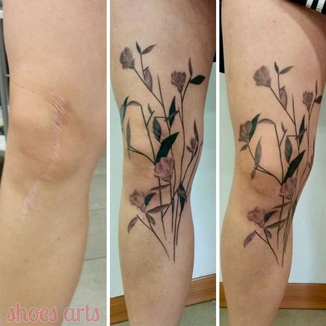 211 Amazing Tattoos That Turn Scars Into Works Of Art Tattoo Ideas For Leg, Tattoo Over Scar, Stunning Tattoos, Scar Cover Up, Tattoos To Cover Scars, Scar Tattoo, Omerta Tattoo, Skeleton Hand Tattoo, Back Of Shoulder Tattoo