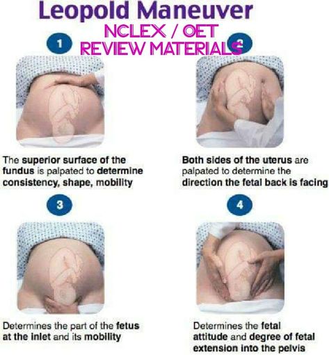 Leopold's Maneuver  @nurselinds2018   Thanks to OP!  #Leopoldsmaneuver #nursing #stydentnurse #laboranddelivery #antepartum Abscess Tooth, Obstetrics Nursing, Midwifery Student, Newborn Nursing, Dentist Teeth, Child Nursing, Student Midwife, Labor Delivery Nursing, Nurse Study Notes