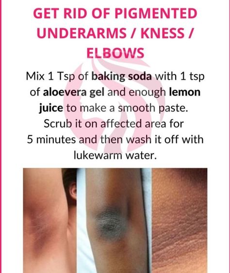 Beginner Skin Care Routine, Skin Care Aesthetic, Face Skin Care Routine, Natural Skin Care Remedies, Diy Skin Care Routine, Natural Face Skin Care, Good Skin Tips, Skin Care Face Mask, Basic Skin Care Routine