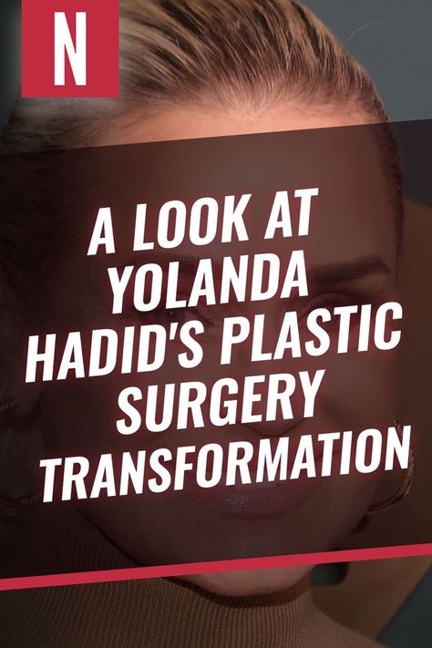 Anyone who has been following Yolanda Hadid would know that she has a love-hate relationship with plastic surgery. #plasticsurgery #yolandahadid #celebplasticsurgery Yolanda Hadid, Real Housewives Of Beverly Hills, Housewives Of Beverly Hills, Cosmetic Surgery, Real Housewives, Plastic Surgery, Beverly Hills, Surgery, Swift