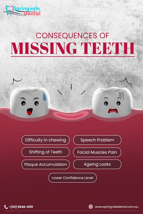 Missing teeth, Dentures Springvale, Implant Supported Overdentures, Dental Implants, Springvale Dental, Springvale Dental Clinic, Springvale Dentists, Emergency Dentists Springvale, Dentist In Springvale, Dental Content Ideas, Dentist Advertising, Medical Ads, Dental Content, Dental Post, Dental Poster, Dental Pictures, Snap On Smile, Dental Quotes