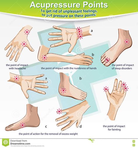 Massage Therapy Acupressure Points Stock Vector - Illustration of ache, alternative: 73579549 Acupuncture Points Chart, Pressure Points For Headaches, Shiatsu Massage Acupressure, Acupuncture Benefits, Joints Pain Remedy, Acupressure Therapy, Reflexology Massage, Cupping Therapy, Shiatsu Massage