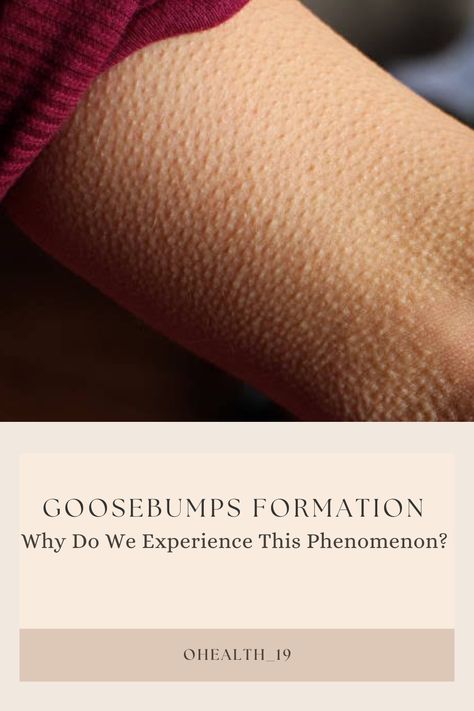 Reasons for Goosebumps Goosebumps On Skin, Goose Bumps Tattoo, Goosebumps Meaning, Goosebumps Collection, Goose Bumps, Goosebumps Books, Skin Bumps, Hair Follicles, The Science