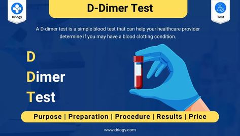 D-Dimer Test For Abnormal Blood Clots in Body: Drlogy Test Price, Result & Range D Dimer, Vein Thrombosis, Student Guide, Medical Tests, Blood Test, Medical Students, Biology, Health Care, Lab