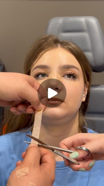 Nose Tape Before And After, Nose Taping, Non Surgical Nose Job, Rhinoplasty Recovery, Nose Surgery Rhinoplasty, Crooked Nose, Nose Jobs, Rhinoplasty Nose Jobs, Rhinoplasty Before And After