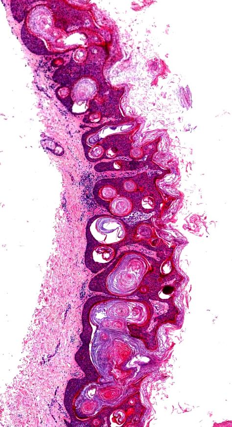 Wallpaper Backgrounds Medical, Cytology Aesthetic, Histology Wallpaper, Pathology Wallpaper, Microscope Wallpaper, Histology Aesthetic, Neuroscience Wallpaper, Pathology Aesthetic, Microscope Aesthetic