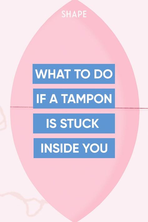 No, it's not lost forever. But you're definitely going to want to get it out. Here's how. #healthandwellness #tampon #period #health Why Am I Not Getting My Period, How To Use A Tampon, How To Put A Tampon In Step By Step, How To Get Ur Period Faster, How To Insert A Tampon, How To Use A Tampon For The First Time, How To Put In A Tampon, Tampon Tips, Tampons Aesthetic