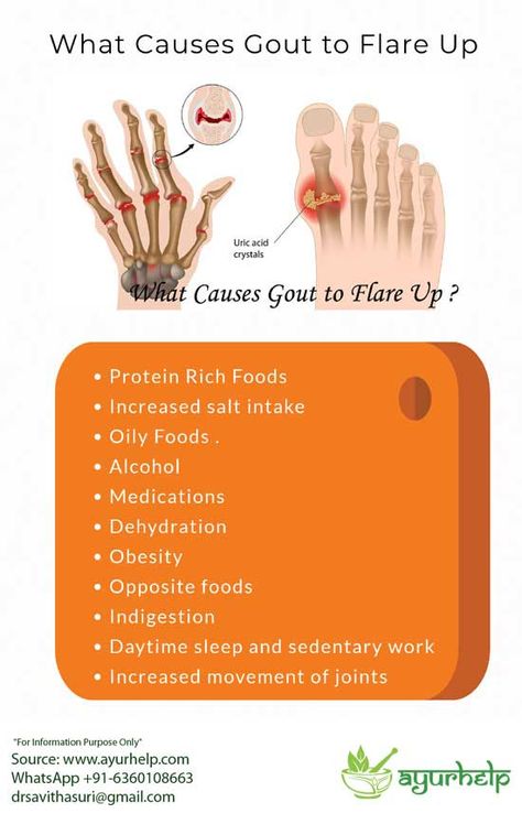 Texts of Ayurveda explain effective natural ayurvedic home remedies which help in gout and also to reduce uric acid levels. These herbal formulae effectively help to reduce joint pain and inflammation. uric acid control medicine (gout medicine ) Table of contents What is Gout in Ayurveda? Causes of Gout – According to Ayurveda Symptoms of […] Uric Acid Crystals, Uric Acid Levels, Ayurvedic Diet, Degenerative Disease, Blood Pressure Medications, Homemade Facials, Protein Rich Foods, Uric Acid, Ayurvedic Herbs