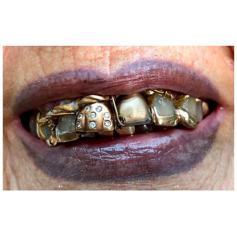 Instagram photo by MICHELE LAMY • Jun 14, 2018 at 3:07 AM Michelle Lamy, Michele Lamy, Tooth Gem, Gold Teeth, Teeth Jewelry, Advanced Style, Jewelry Inspo, Mode Inspiration, Italian Charm Bracelet