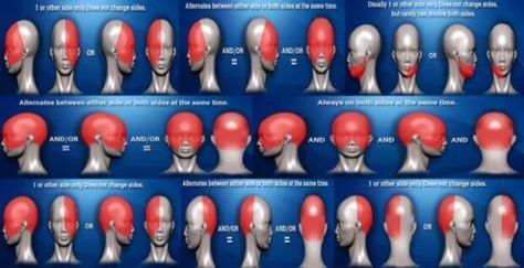 Types Of Headaches Chart, Headache Location Meaning, Headache Meaning, Headache Location, Headache Chart, Different Headaches, Headache Medicine, Occipital Neuralgia, Migraine Headache