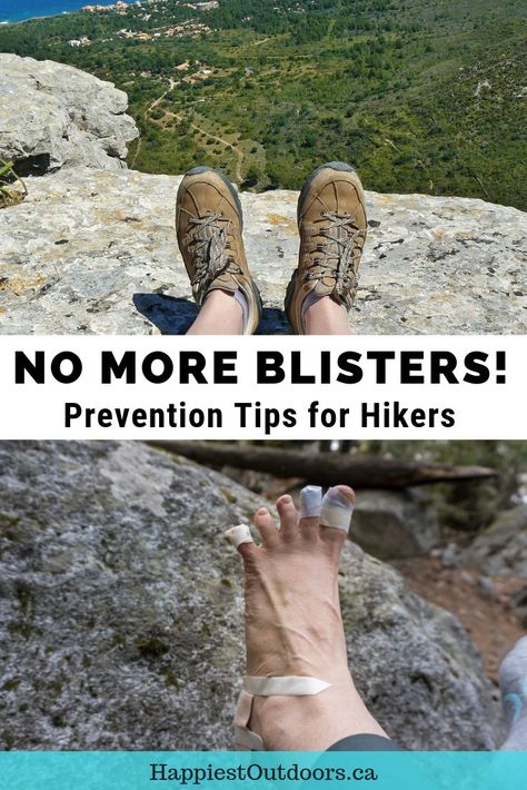 How to prevent blisters while hiking. Keep your feet happy on hikes with these blister prevention tips. Also includes info on how to treat blisters if they do happen. #hiking #blisters #hikingtips How To Treat Blisters, Hiking First Aid Kit, Hiking Training, Prevent Blisters, Backcountry Camping, Backpacking Trip, Backpacking Tips, Backpacking Gear, Hiking Tips