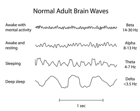 Sleep is wonderful – when you’re tired, nothing feels better!  But why do we need to sleep?  And why do we dream? Rpsgt Study, Sleep Physiology, Sleep Technologist, Uni Notes, Why Do We Dream, Physics Projects, Medical Notes, Basic Anatomy And Physiology, Stages Of Sleep