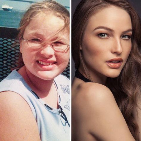 16 Ugly ducklings who grew up. Glow Up In 3 Months, Glow Up Videos, Glow Up Routine, Glowing Skin Tips, Glow Ups, Glowing Skin Diy, Bushy Eyebrows, Get Glowing Skin, Glowing Skin Mask