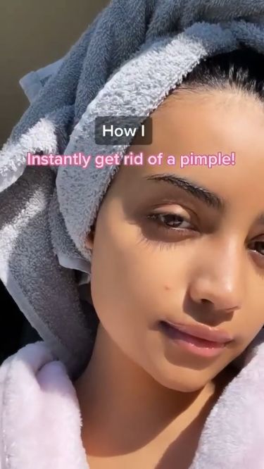 Pimple Problems No More: Your Guide to Pain-Free Skin How To Treat Pimples, Closed Comedones, Natural Remedies For Acne, Skin Blackheads, Pimple Free Skin, Remedies For Acne, Clear Glowing Skin, Natural Acne Remedies, Types Of Acne