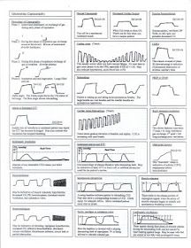 Respiratory Therapy Cave: Capnography Cheat Sheet Respiratory Therapy Notes, Respiratory Therapist Student, Anesthesia School, Respiratory Therapy Student, Emt Study, Paramedic Student, Nurse Anesthesia, Nursing Cheat Sheet, Paramedic School