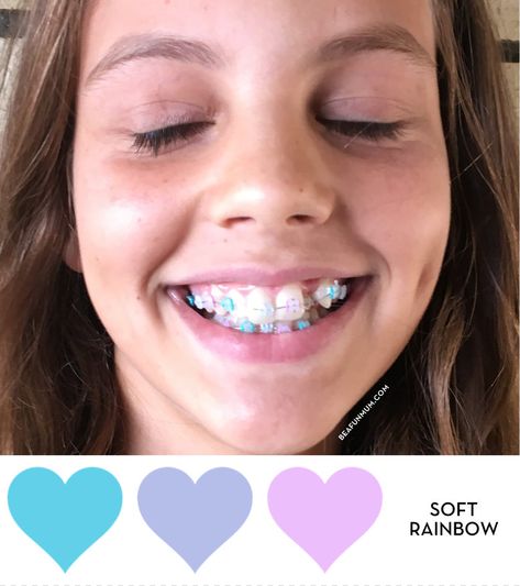 Clarity™ ADVANCED Ceramic Braces Braces For Kids, Ceramic Braces With Colored Bands, Ceramic Braces Color Bands, Ceramic Braces, Kids Braces, Getting Braces, Teeth Braces, Braces Colors, Advanced Ceramics