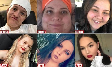 Women have shared their glow ups in a variety of before and afters Glow Up Pictures Before And After, Glo Up Transformation Before And After, Before And After Glow Up, Glow Up 2 Weeks Before School, Before And After Glow Up Pics, Lose Pounds, Best Diet Plan, Skin Care Solutions, Bad Habits