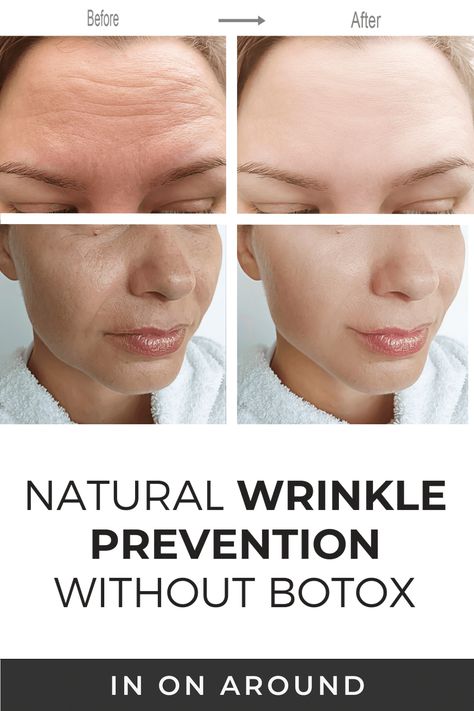 Natural Botox For Wrinkles Dr. Oz, Natural Ways To Reduce Wrinkles, Natural Botox For Wrinkles, At Home Botox Skin Care, Best Botox Alternatives, Homemade Botox Anti Aging, Skincare Wrinkles, Natural Botox Alternative, Diy Botox Face Mask