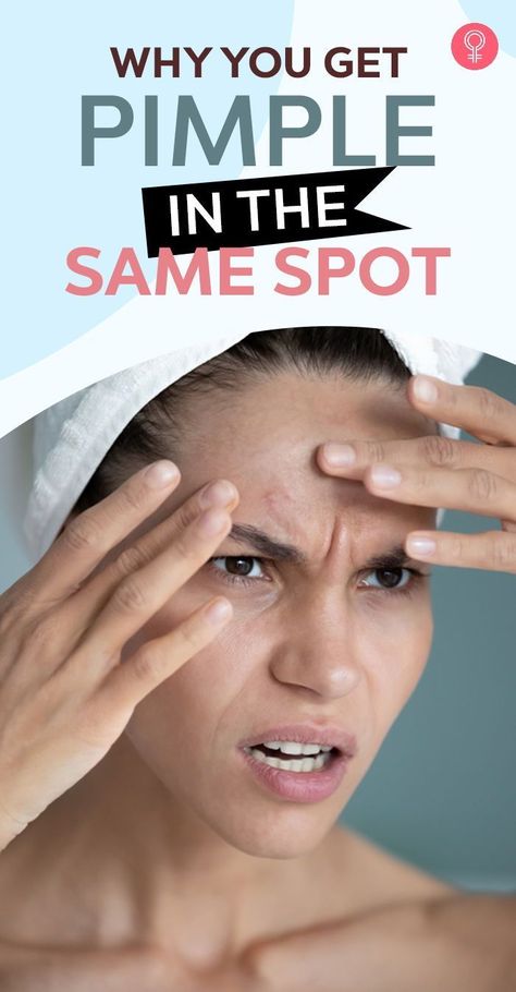 Why You Get Pimple In The Same Spot #beauty #beautyhacks #pimple #acne, #pimples #overnightpimples #removepimples #removepimplesovernight https://whispers-in-the-wind.com/combatting-pimples-under-the-skin-expert-tips-and-product-recommendations/?206 Neck Pimples, Hormonal Cycle, Blind Pimple, Pimples Under The Skin, Pimples Overnight, Pimples Remedies, Pimples On Face, Natural Acne Remedies, How To Get Rid Of Pimples