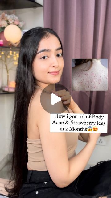 Kareena Tekwani | Beauty Influencer💜 on Instagram: "Got rid of strawberry legs, body acne & tanning in just 2 months😱😍

Sooo, i’ve faced the problem of strawberry legs & bumpy dry skin for the LONGEST time! And i literally couldn’t believe the fact when i saw a subsequent reduction in just a few months!🙈

I used the @mywishcare AHA+BHA Body lotion that has the goodness of 10% AHA along with Salicylic acid which is perfect to give you a soft, clear, hydrated & tan-free skin!

Definitely a 10/10 for me! Don’t forget to show your love if you found it useful ✨💞

#bodytanning #strawberrylegs #bumpyskin #ahabodylotion #ahaandbha #detan #bodytanning #bodyacne #clearskin #strawberrylegsremedy #bodymask #bodylotionunder500" Leg Acne, Strawberry Legs, Bumpy Skin, Body Acne, Body Mask, Aha Bha, Acne Free, Beauty Influencer, Salicylic Acid