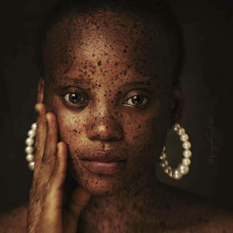 Dark Freckles, Unique Faces, African People, Black Artwork, Feminine Aesthetic, Black Is Beautiful, Her Hair, Pretty People, Portrait Photography