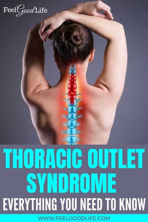 Shoulder Pain Remedies, Nerve Pain Remedies, Thoracic Outlet, Sciatic Nerve Relief, Sciatica Symptoms, Everything Hurts, Nerve Health, Sciatica Relief, Nerve Pain Relief