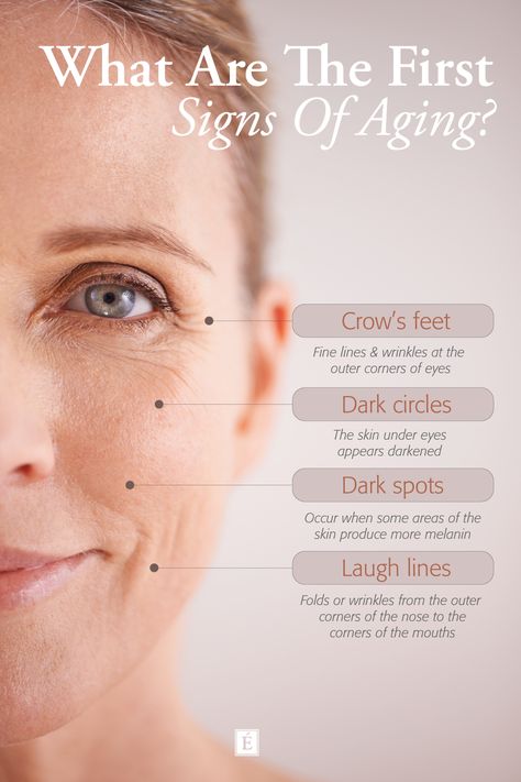 Graphic featuring woman's face showing the signs of aging skin Skincare Infographic Design, Botox Infographic, Medspa Posts, Skin Infographic, Beauty Infographic, Skincare Facts, Skin Facts, Eminence Organic Skin Care, Green Tea Face