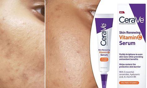 Cerave Skin Renewing Vitamin C Serum, Cera Ve Vitamin C Serum, Cerave Vitamin C Serum, Skin Breaking Out, Mild Acne, Vitamin C Benefits, Retinol Serum, Hyaluronic Acid Serum, Skin Serum