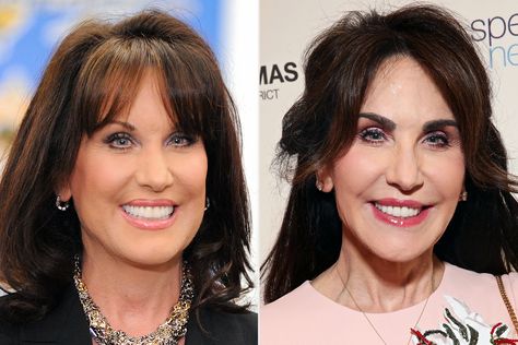 Robin McGraw Addresses Plastic Surgery Rumors, Reveals an Eyebrow Transplant 'Changed' Her Look Robin Mcgraw Plastic Surgery, Robin Mcgraw, Facelift Procedure, Eyebrow Transplant, Nose Reshaping, Laser Skin Resurfacing, Face Lift Surgery, Bubblegum Balloons, Dr Phil