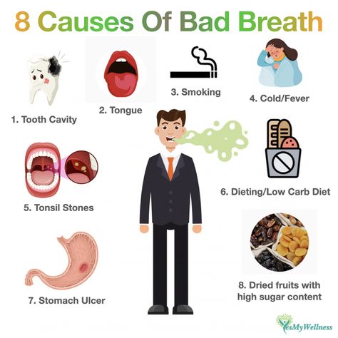 Most of the time we don’t realise we have bad breath. It can be due to : 1. Tongue : Main cause. Brush your tongue with toothbrush or a tongue brush. Regular gargling with mouthwash helps too. 2. Going on a low carb diet : Body will burn fat, producing ketones and this causes our mouth to ‘smell’. 3. Stomach ulcer : Stomach ulcer alone won’t cause bad breath but the resulting bacteria H Pilori, will cause bad breath. 4. Tonsil stones : This whitish lump is formed from bacteria, leftover food Bad Smell From Mouth, Tongue Brush, Causes Of Bad Breath, Tooth Cavity, Leftover Food, Bad Breath Remedy, Stomach Ulcers, Leftovers Recipes, Carb Diet