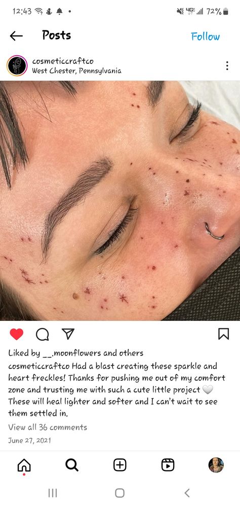 Freckle Face Tattoo, Freckle Tattoos Hearts, Colored Freckles Tattoo, Star Freckle Tattoo Face, Heart Freckle Tattoo Face, Color Freckles Tattoo, Tattoo Beauty Mark Face, Face Scar Tattoo, Freckle Constellation Tattoo