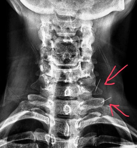 The Patient, Radiology, X Ray, Quick Saves