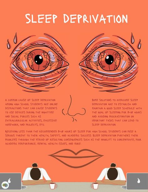 A common cause of sleep deprivation among high school students are online distractions that can cause students to use devices during the nighttime and social forces such as extracurricular activities, excessive homework, and projects, etc. Sleep Deprived Art, Sleep Deprivation Effects, How To Avoid Sleep While Studying Tips, Avoid Sleep While Studying, Extracurricular Activities, Sleep Deprived Memes Hilarious, Sleep Deprived, Sleep Schedule, Classic Movie Posters