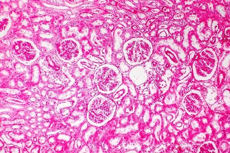 Histology of human kidney Kidney Histology, Human Kidney, Weird Science, Stock Photography, Stain, Science, Tapestry, Human, Photography