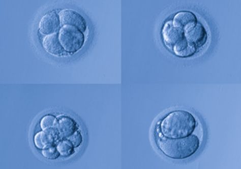 A new test aims to improve the subjective visual practice of #embryo selection in vitro fertilization with better imaging and data.  #IVF #eevatest  https://www.eevatest.com/?fa_o_source_group=social&fa_o_source=pinterest Dhea Supplement, Invitro Fertilization, Chromosomal Abnormalities, Fertility Tips, Human Embryo, Assisted Reproductive Technology, Egg Donation, Embryo Transfer, Natural Fertility