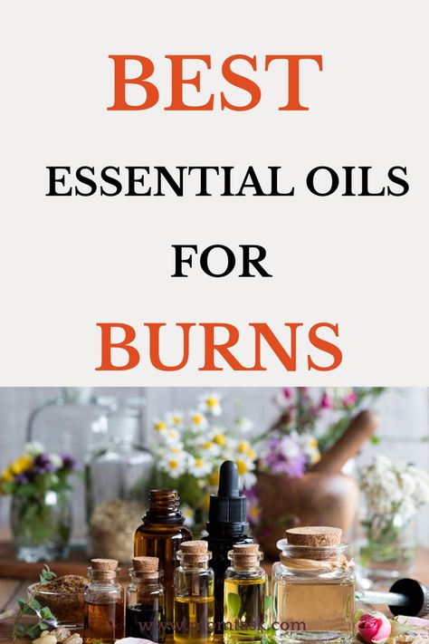 Discover the best essential oils to help was and heal burns. Essential oil are a great natural remedy for many ailments. Use essential oils for burns. #essentialoilblends #naturalmedicineremedies #burns #burn #wound #healing Essential Oils For Burns On Skin, Natural Remedies For Burns, Essential Oil For Burns, Burn Wound, Home Remedies For Burns, Essential Oil Mixtures, How To Heal Burns, Juniper Essential Oil, Top Essential Oils