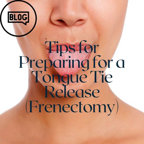 Tips For Preparing For a Tongue Tie Release Tongue Thrust, Myofunctional Therapy, Crooked Teeth, Poor Digestion, Jaw Pain, Tongue Tie, Surgery Recovery, Nasal Congestion, Poor Posture